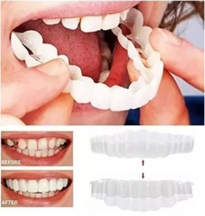 Carillas Dentales